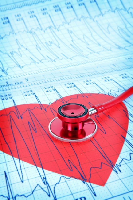 Update on the Cardiovascular Market in Asia